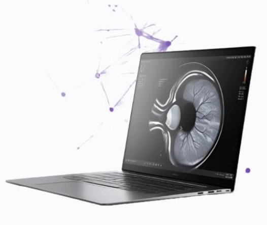 OptiClarity AI-powered eye health analysis interface